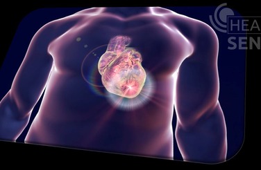 Coronary surgery in ACUTE MIOCARDIAL INFARCTION - 2020