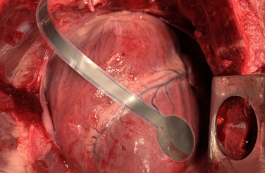 Stick it to the beating heart!